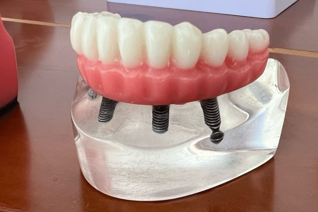implantes dentales en loja